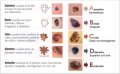 Reglas ABCDE Rosvel vigilar tus lunares